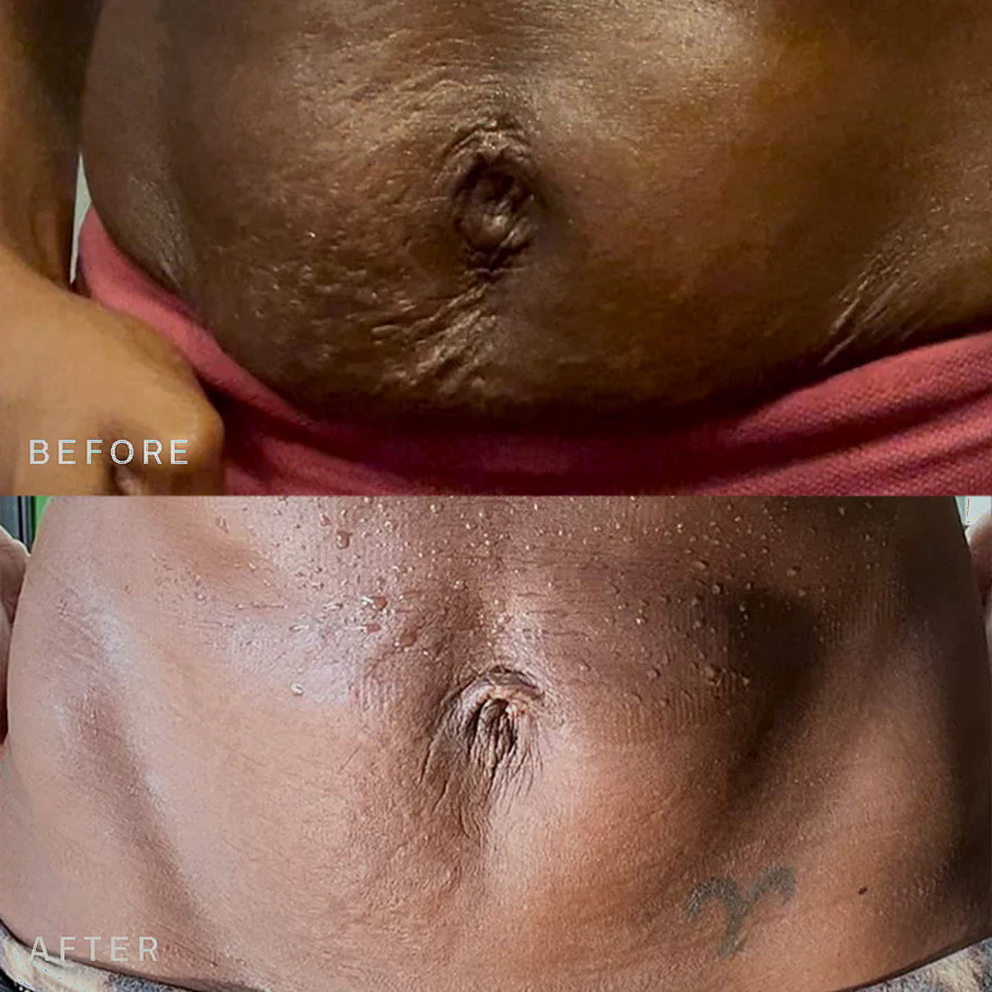 Fiyora SmoothTone™
