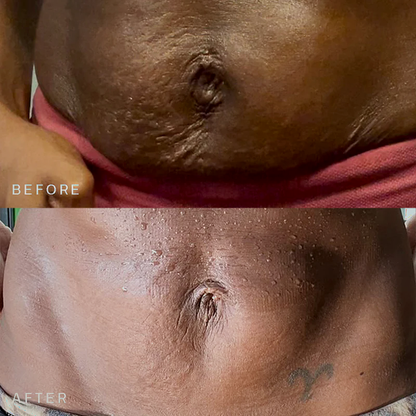Fiyora SmoothTone™